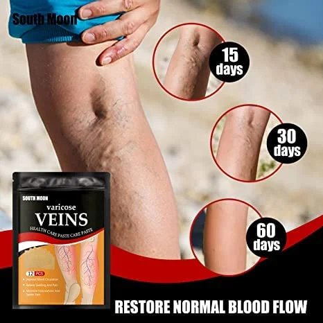 Varicose Vein Patch Set Of 12 Patch In One Pack photo 4