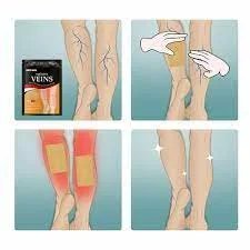 Varicose Vein Patch Set Of 12 Patch In One Pack photo 5